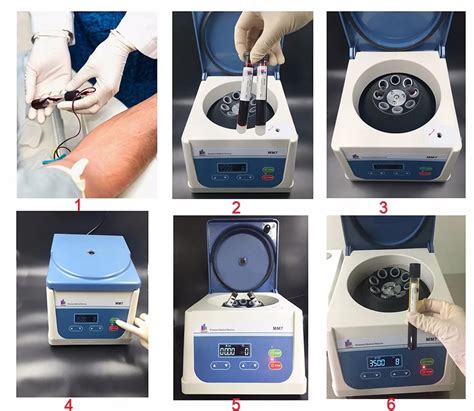 Platelet Centrifuges 